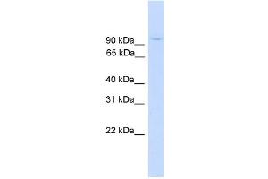 WB Suggested Anti-ZNF224 Antibody Titration: 0. (ZNF224 抗体  (Middle Region))
