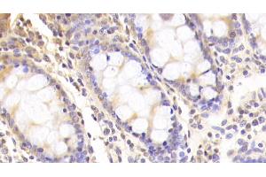 Immunohistochemistry (IHC) image for anti-Sirtuin 3 (SIRT3) (AA 126-399) antibody (ABIN7435922)
