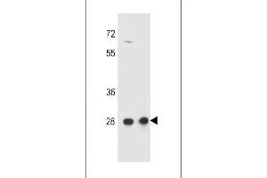 CCD Antibody (C-term) (ABIN657166 and ABIN2846300) western blot analysis in HepG2,CEM cell line lysates (35 μg/lane). (CCDC134 抗体  (C-Term))