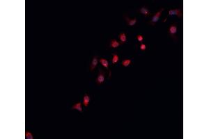 ABIN6266931 staining K-562 cells by IF/ICC. (STEAP3 抗体  (N-Term))