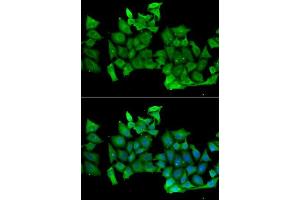 Immunofluorescence analysis of MCF-7 cells using RHOH antibody. (RHOH 抗体  (AA 1-191))