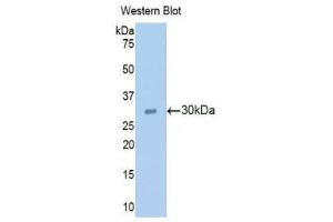 Western Blotting (WB) image for anti-Ribonuclease L (2',5'-Oligoisoadenylate Synthetase-Dependent) (RNASEL) (AA 358-583) antibody (ABIN1860458) (RNASEL 抗体  (AA 358-583))