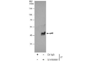 Immunoprecipitation (IP) image for anti-Rab9 Effector Protein with Kelch Motifs (RABEPK) antibody (ABIN2856403)