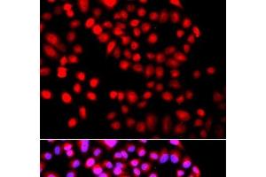 Immunofluorescence analysis of A549 cells using SETD6 Polyclonal Antibody (SETD6 抗体)