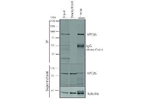 Immunoprecipitation (IP) image for anti-Vacuolar Protein Sorting 35 (VPS35) antibody (ABIN6933004)