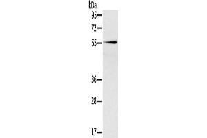 Western Blotting (WB) image for anti-Solute Carrier Family 16, Member 10 (Aromatic Amino Acid Transporter) (SLC16A10) antibody (ABIN2427205) (SLC16A10 抗体)
