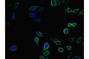 Immunofluorescent analysis of Hela cells using ABIN7151860 at dilution of 1:100 and Alexa Fluor 488-congugated AffiniPure Goat Anti-Rabbit IgG(H+L) (EPH Receptor B2 抗体  (AA 261-465))