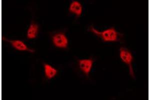 ABIN6274676 staining HeLa by IF/ICC. (BARD1 抗体  (Internal Region))