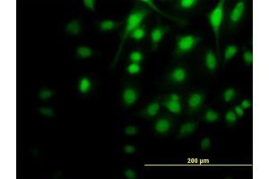 Immunofluorescence of monoclonal antibody to MAP2K5 on HeLa cell.