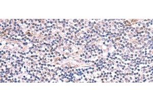 Immunohistochemistry of paraffin-embedded Human tonsil tissue using INPP5K Polyclonal Antibody at dilution of 1:85(x200) (INPP5K 抗体)