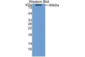 Western Blotting (WB) image for anti-Vitamin D-Binding Protein (GC) (AA 17-476) antibody (ABIN1980543) (Vitamin D-Binding Protein 抗体  (AA 17-476))