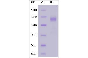 SDS-PAGE (SDS) image for SARS-CoV-2 Spike S1 (B.1.1.7 - alpha) (Active) protein (Fc Tag) (ABIN6992403)
