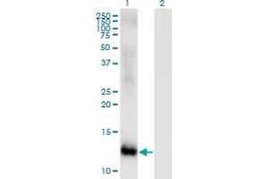 Western Blot analysis of MSRB2 expression in transfected 293T cell line by MSRB2 monoclonal antibody (M01), clone 2B7. (MSRB2 抗体  (AA 102-201))