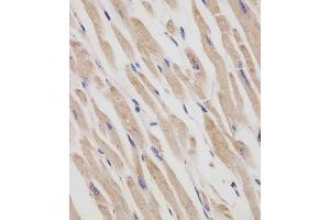 (ABIN6242408 and ABIN6577250) staining RANBP9 in human heart tissue sections by Immunohistochemistry (IHC-P - paraformaldehyde-fixed, paraffin-embedded sections). (Importin 9 抗体  (AA 1-388))