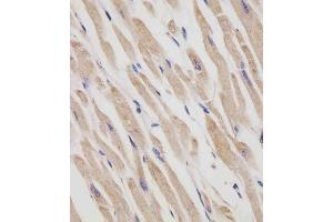 (ABIN6242408 and ABIN6577250) staining RANBP9 in human heart tissue sections by Immunohistochemistry (IHC-P - paraformaldehyde-fixed, paraffin-embedded sections). (Importin 9 抗体  (AA 1-388))