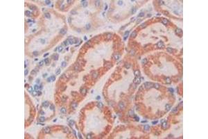 IHC-P analysis of Kidney tissue, with DAB staining. (M6PR 抗体  (AA 27-185))