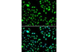 Immunofluorescence analysis of MCF-7 cells using L3MBTL3 antibody (ABIN5974391). (L3MBTL3 抗体)