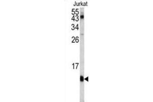 Western Blotting (WB) image for anti-FK506 Binding Protein 1A, 12kDa (FKBP1A) antibody (ABIN3003472) (FKBP1A 抗体)
