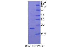 SDS-PAGE analysis of Pig RBP2 Protein. (RBP2 蛋白)