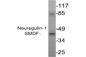 Image no. 2 for anti-Neuregulin 1 (NRG1) antibody (ABIN265466) (Neuregulin 1 抗体)