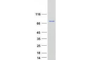 Western Blotting (WB) image for Osteoactivin (GPNMB) (Transcript Variant 1) protein (Myc-DYKDDDDK Tag) (ABIN2722179)