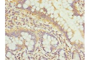 Immunohistochemistry of paraffin-embedded human small intestine tissue using ABIN7163882 at dilution of 1:100 (GALNT3 抗体  (AA 1-140))