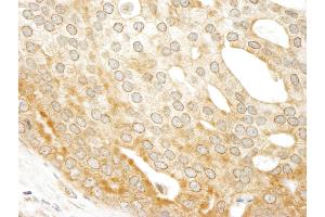Immunohistochemistry (IHC) image for anti-ATP-Binding Cassette, Sub-Family F (GCN20), Member 1 (ABCF1) (AA 795-845) antibody (ABIN7453873)