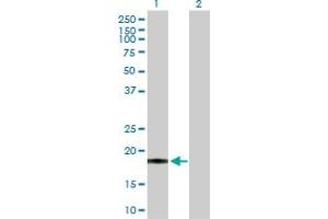 Western Blot analysis of PSCA expression in transfected 293T cell line by PSCA MaxPab polyclonal antibody. (PSCA 抗体  (AA 1-123))