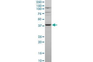 MVK polyclonal antibody (A01), Lot # 051116JC01. (MVK 抗体  (AA 297-396))