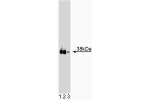 Western blot analysis of JAM-1 on human endothelial lysate. (F11R 抗体  (AA 126-237))
