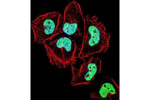 Immunofluorescence (IF) image for anti-Zinc Finger Protein 155 (ZNF155) antibody (ABIN2999111) (ZNF155 抗体)