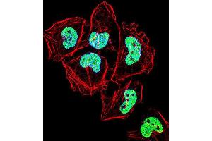 Immunofluorescence (IF) image for anti-Zinc Finger Protein 155 (ZNF155) antibody (ABIN2999111)