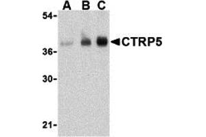 Western Blotting (WB) image for anti-C1q and Tumor Necrosis Factor Related Protein 5 (C1QTNF5) (N-Term) antibody (ABIN1031332) (CTRP5 抗体  (N-Term))