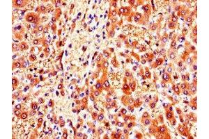 Immunohistochemistry of paraffin-embedded human liver tissue using ABIN7146178 at dilution of 1:100 (ZMPSTE24 抗体  (AA 217-347))
