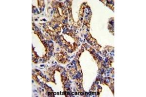 Immunohistochemistry (IHC) image for anti-Tumor-Associated Calcium Signal Transducer 2 (TACSTD2) antibody (ABIN3002746) (TACSTD2 抗体)