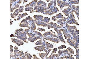 IHC analysis of Aconitase 2 using anti-Aconitase 2 antibody (ABIN7602770). (ACO2 抗体  (C-Term))