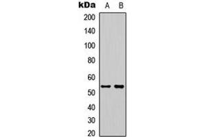Western blot analysis of STEAP3 expression in HeLa (A), HepG2 (B) whole cell lysates. (STEAP3 抗体  (C-Term))