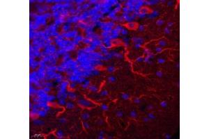 Immunofluorescent analysis of paraformaldehyde-fixed mouse brain using TRIM46 (ABIN7076020) at dilution of 1: 3200 (TRIM46 抗体)