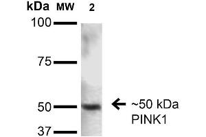 Western Blot analysis of Rat Brain showing detection of ~50 kDa PINK1 protein using Mouse Anti-PINK1 Monoclonal Antibody, Clone S4-15 . (PINK1 抗体  (AA 112-496) (PE))