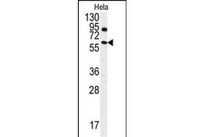 Western blot analysis of anti-ANTXR1 Antibody  (ABIN392154 and ABIN2841879) in Hela cell line lysates (35 μg/lane). (ANTXR1 抗体  (AA 358-386))
