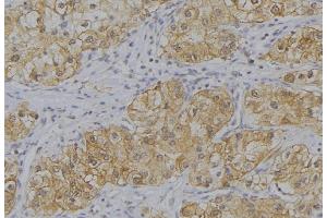ABIN6273649 at 1/100 staining Human uterus tissue by IHC-P. (IL12B 抗体  (C-Term))