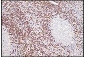 Immunohistochemistry (IHC) image for anti-CD8 (CD8) (C-Term) antibody (ABIN870515) (CD8 抗体  (C-Term))