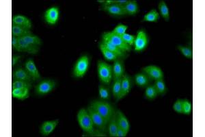 Immunofluorescence staining of HepG2 cells with ABIN7165566 at 1:133, counter-stained with DAPI.