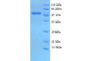 SDS-PAGE (SDS) image for Isocitrate Dehydrogenase 1 (NADP+), Soluble (IDH1) (AA 7-407), (partial) protein (His tag) (ABIN5709697) (IDH1 Protein (AA 7-407, partial) (His tag))