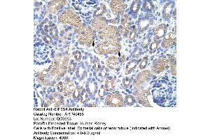 Rabbit Anti-EIF3S4 Antibody  Paraffin Embedded Tissue: Human Kidney Cellular Data: Epithelial cells of renal tubule Antibody Concentration: 4. (EIF3G 抗体  (N-Term))