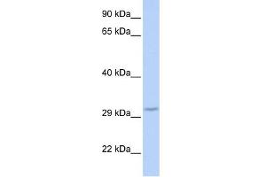 WB Suggested Anti-FBXO27 Antibody Titration: 0. (FBXO27 抗体  (Middle Region))
