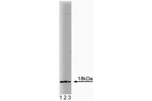 Western blot analysis of Ubc9 on human endothelial lysate. (UBE2I 抗体  (AA 26-156))