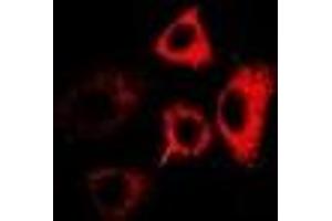 Immunofluorescent analysis of RPL13 staining in MCF7 cells. (RPL13 抗体)