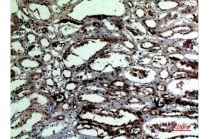 Immunohistochemistry (IHC) analysis of paraffin-embedded Human Kidney, antibody was diluted at 1:100. (Catalase 抗体  (C-Term))