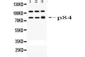 Western blot analysis of STAT1 using anti-STAT1 antibody . (STAT1 抗体  (AA 2-230))